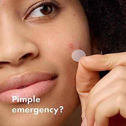 What Are Hydrocolloid Patches for Pimples?