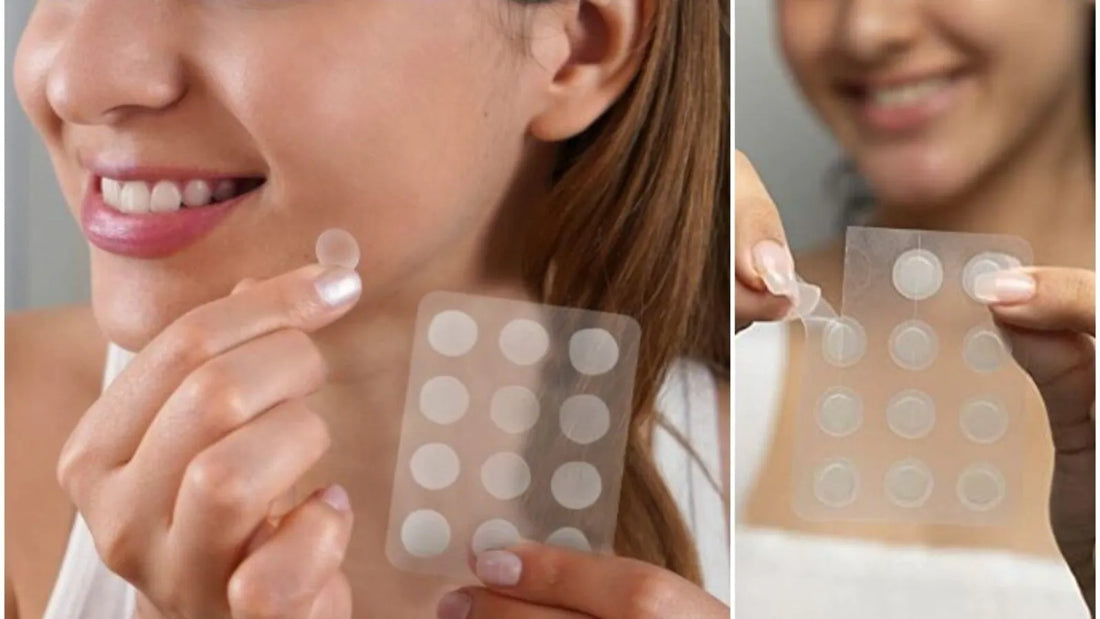 Acne Pimple Patches: What Are Pimple Patches and How They Work